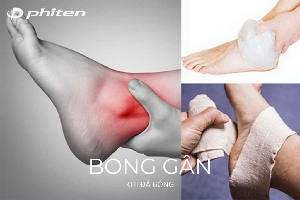 bị bong gân khi chơi đá banh